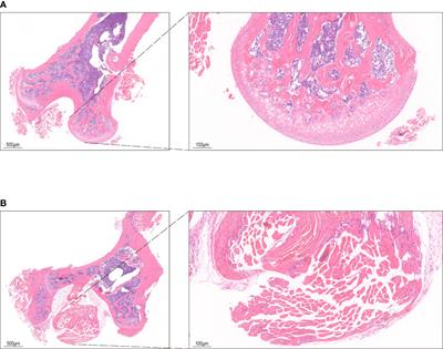 The analysis of Modified Qing’ E Formula on the differential expression of exosomal miRNAs in the femoral head bone tissue of mice with steroid-induced ischemic necrosis of femoral head